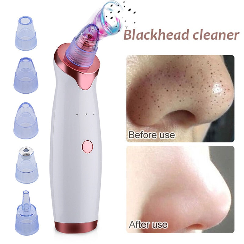 Bestfy™ Electric Blackhead & Acne Remover