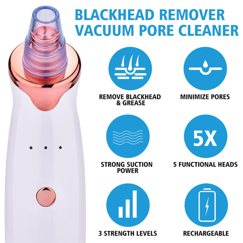 Bestfy™ Electric Blackhead & Acne Remover